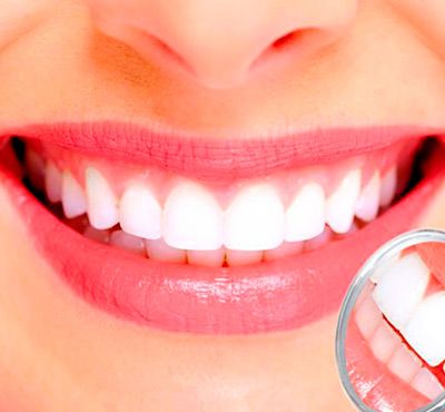 MK Dental dientes blancos